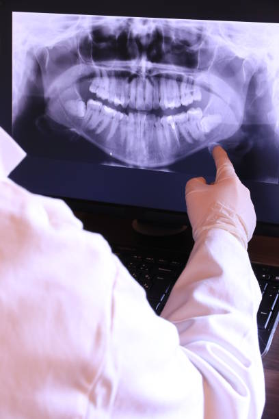 Best Emergency Wisdom Tooth Extraction in Lincoln Center, KS