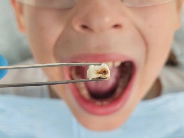 Best After-Hours Dental Care in Lincoln Center, KS